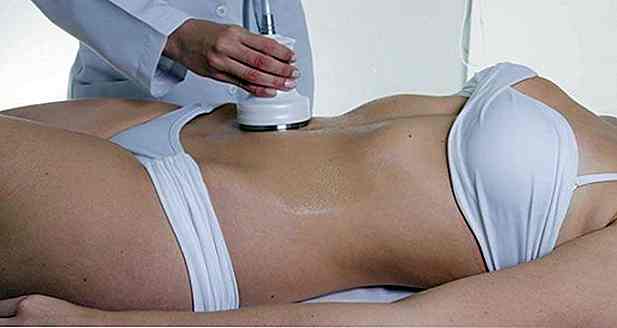 Lipocavitation radiofréquence : le soin miracle anti graisse